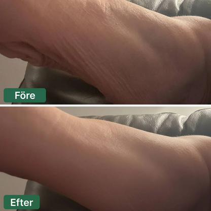 Crepey Skin Repair Treatment